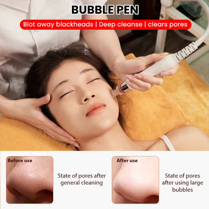 6 w 1 Dermabrazja Peel Spa Urządzenie do Twarzy Odmładzanie Skóry Hydro Dermabrazja Aqua Głębokie Oczyszczanie Urządzenie do Pielęgnacji Skóry